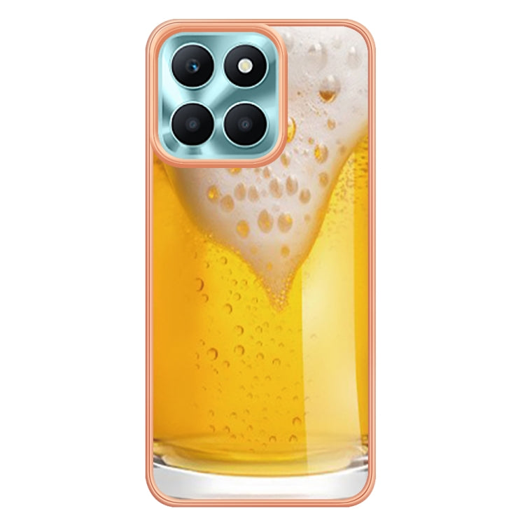 For Honor X6a Electroplating Marble Dual-side IMD Phone Case(Draft Beer) - Honor Cases by buy2fix | Online Shopping UK | buy2fix